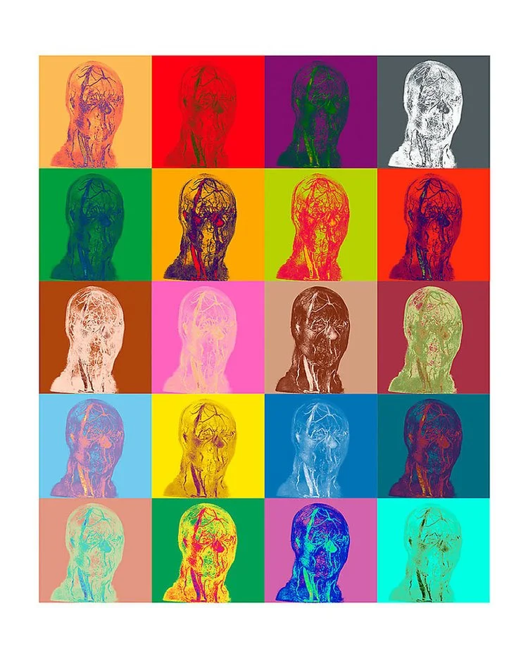 Gallery 1 — Richard Ehrlich Family Foundation